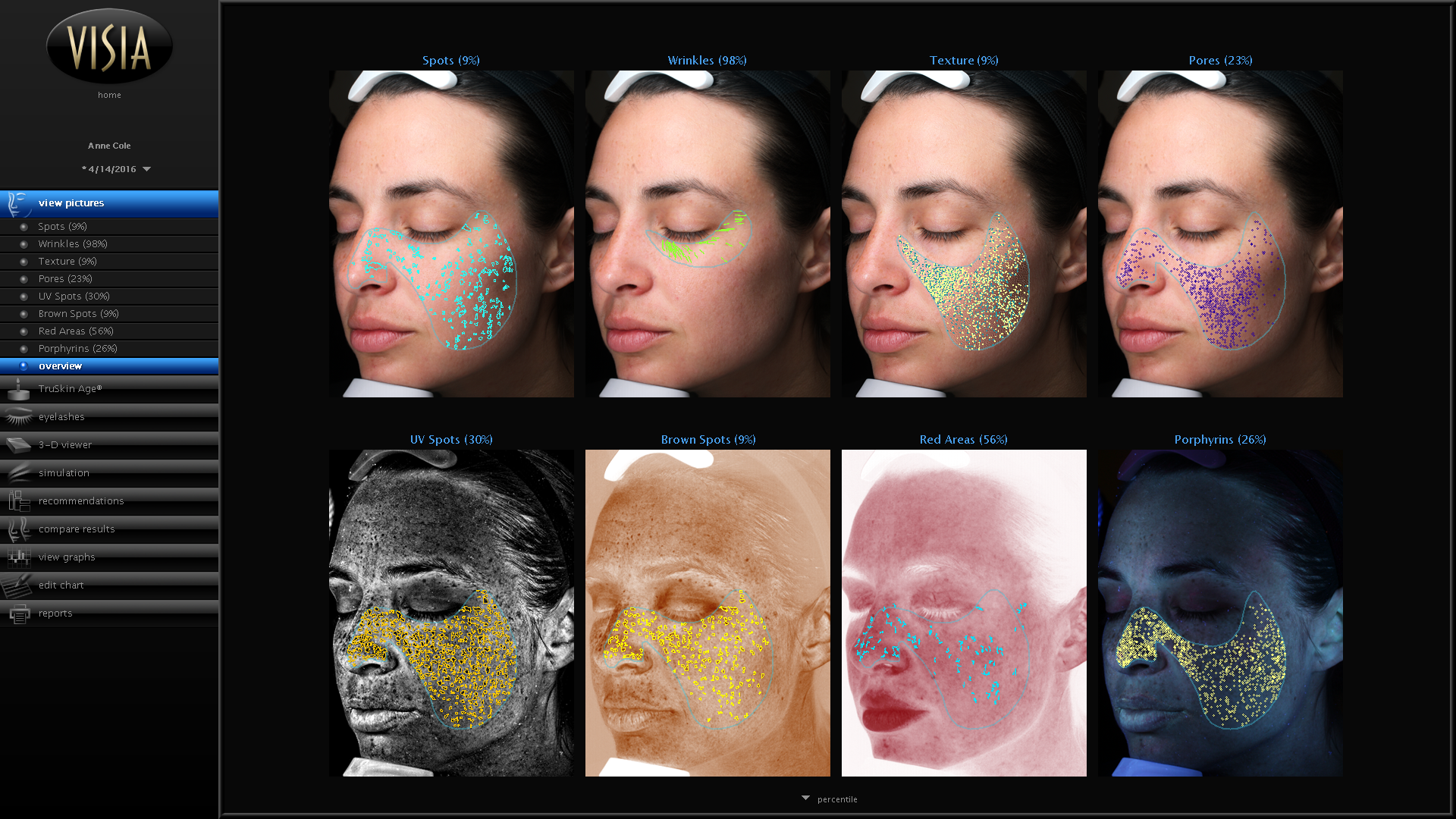 Canfield Scientific's VISIA® Skin Analysis System revealing eight skin features